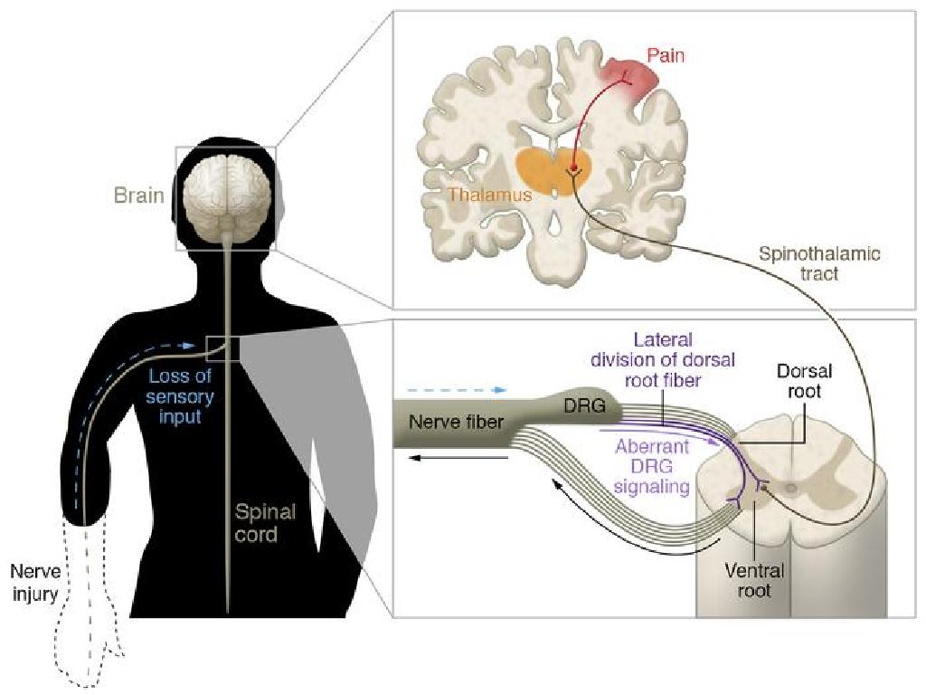 nerve injury pathway