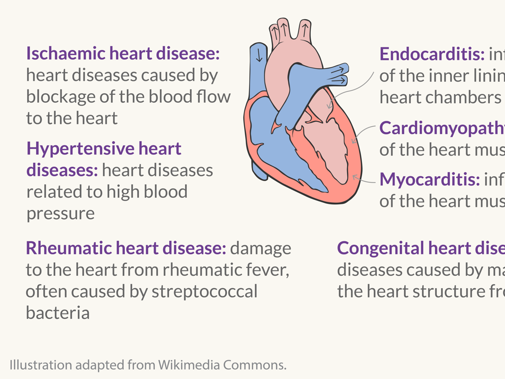 heart disease types